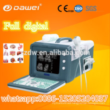 2D protable ultrasound machine price & best price for mobile ultrasonic machine